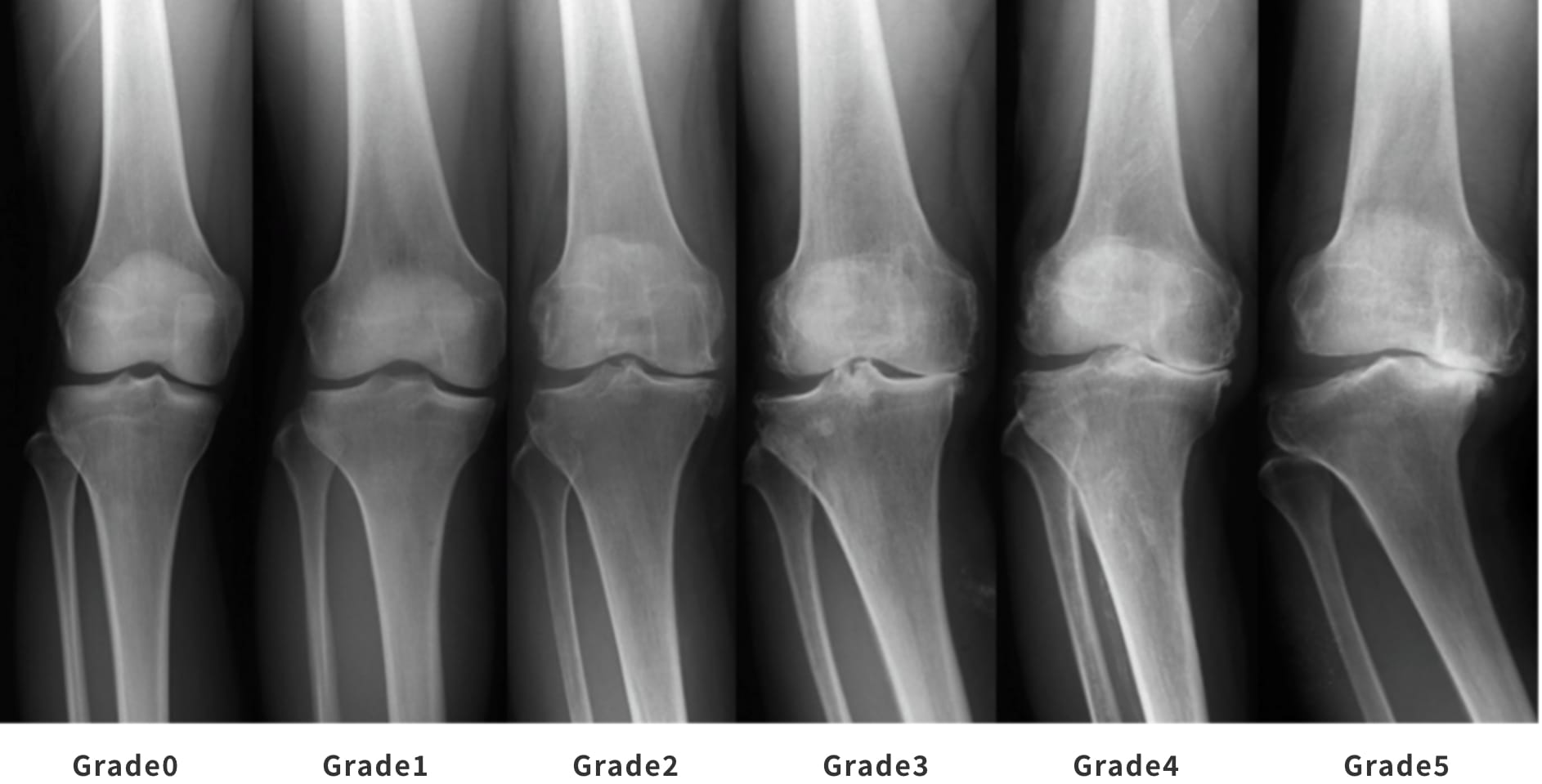  OA 患者の労働者の権利